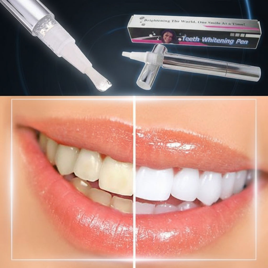 Pluma blanqueadora dental profesional de efecto rápido para sonrisa blanca en casa Veloxa. www.veloxashop.com